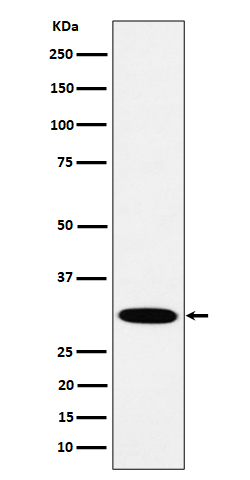 HMGCL