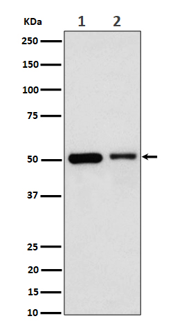 ANXA7