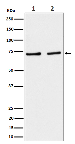 SLC25A12