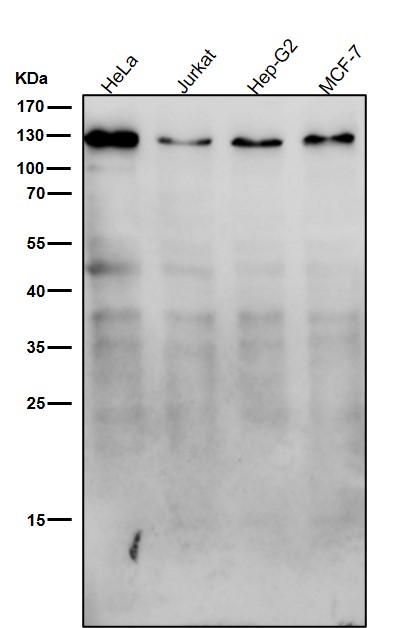 Meckelin