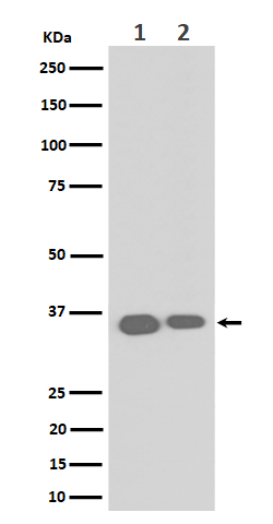 ELOVL5