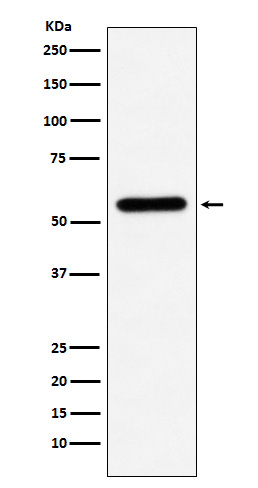 Liver Carboxylesterase 1