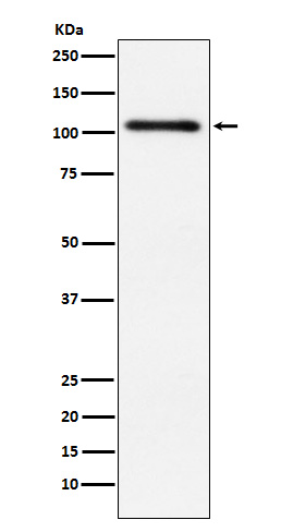 Protein Kinase D2