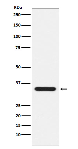 Presenilin 1