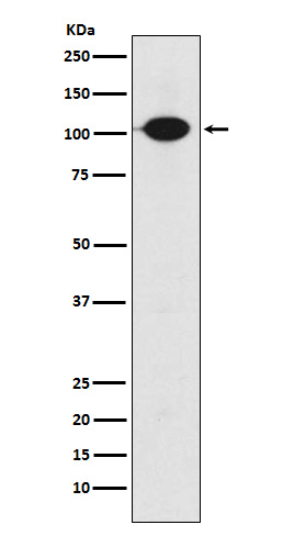 GABA B Receptor 2