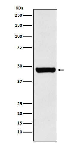 HSC70 Interacting Protein HIP