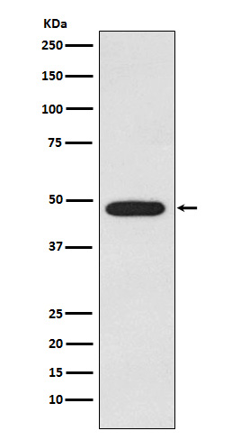 Galactosidase alpha