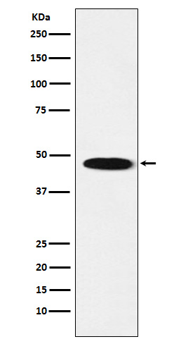 GABA A Receptor beta 1
