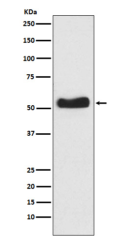 Glucokinase