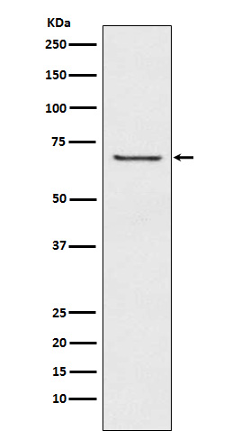 GABA A Receptor beta 2