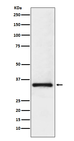 U1A