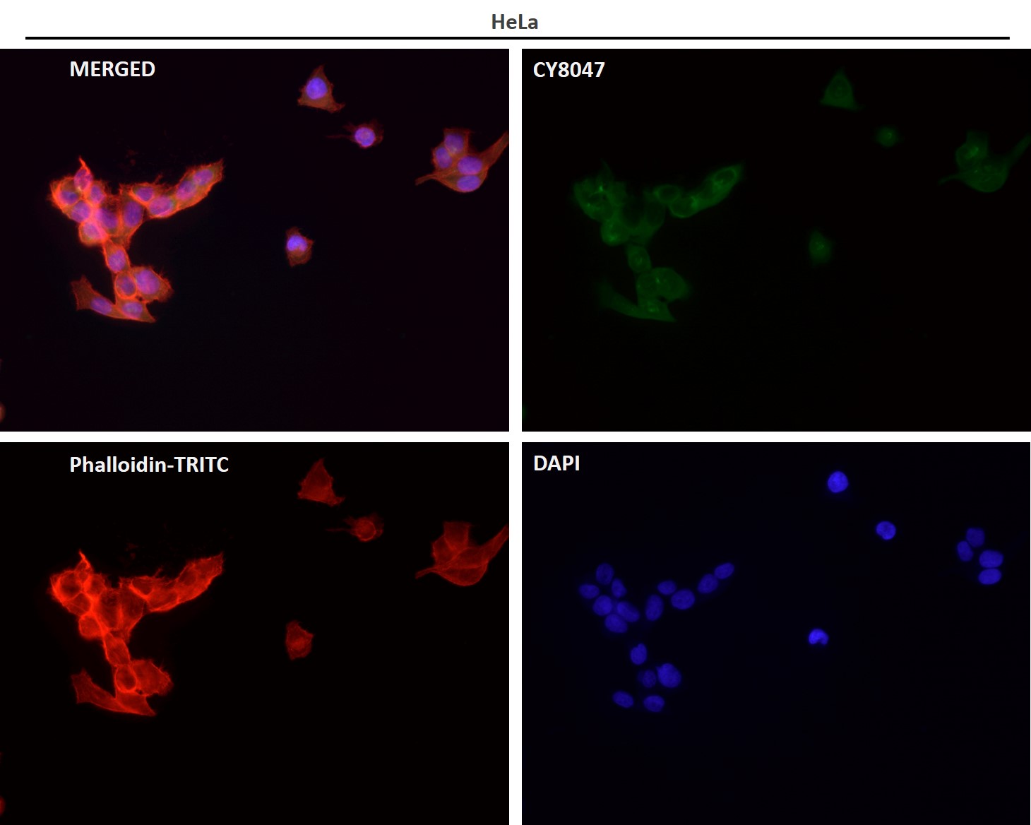 Rabbit Monoclonal to Fructose 6-Phosphate Kinase
