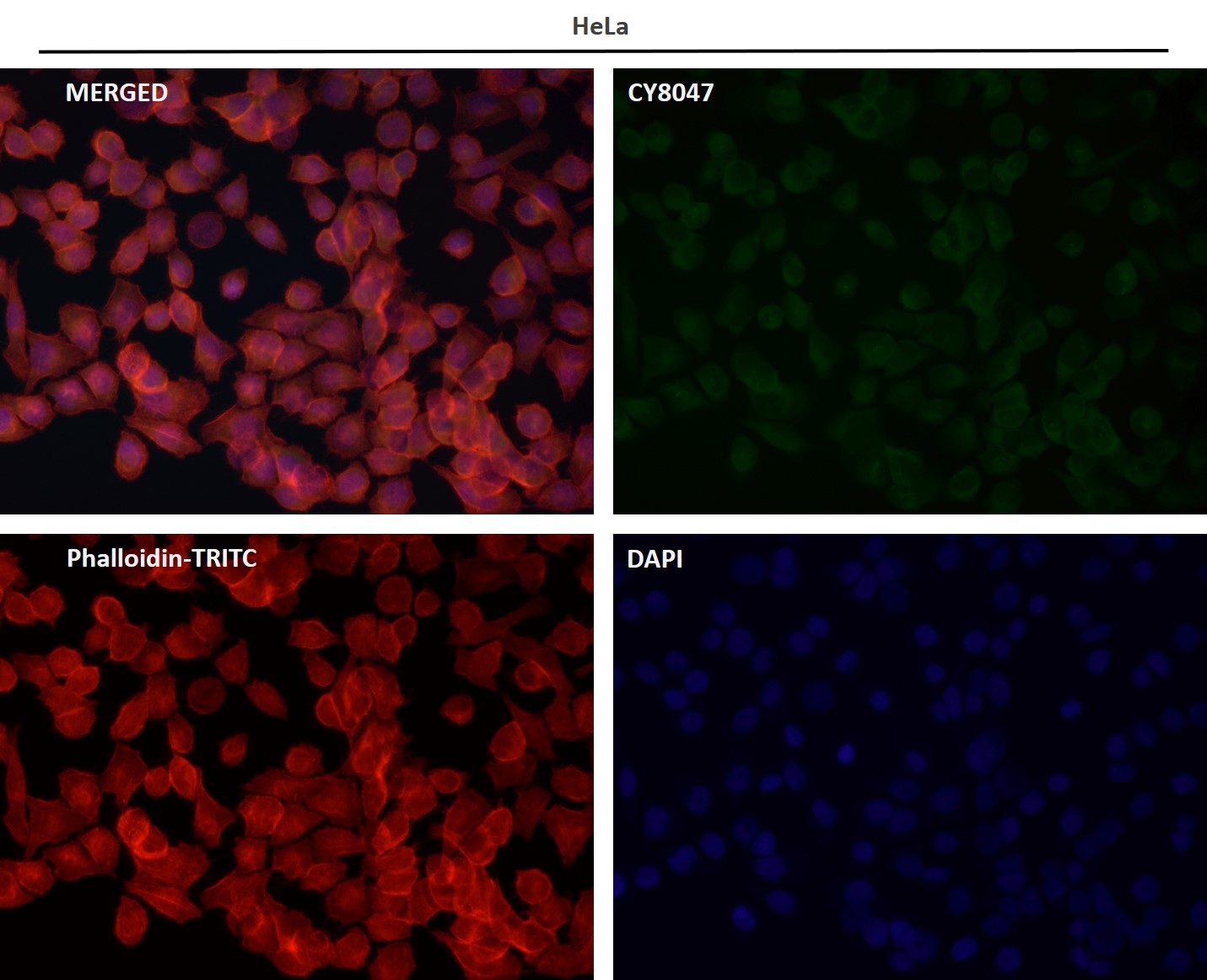 Rabbit Monoclonal to Fructose 6-Phosphate Kinase
