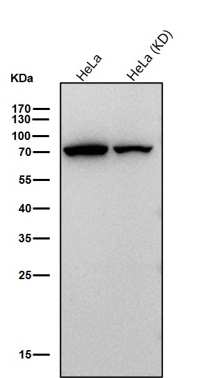 Rabbit Monoclonal to Fructose 6-Phosphate Kinase