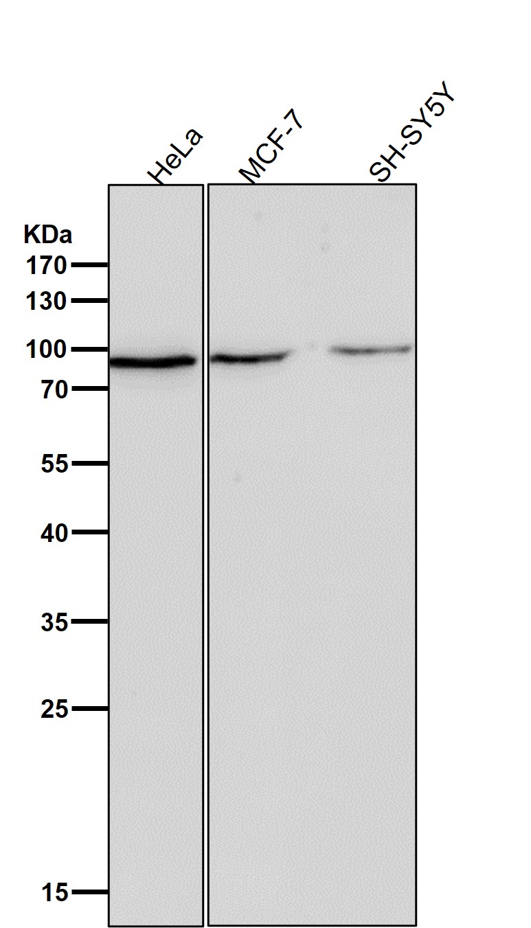 Rabbit Monoclonal to Fructose 6-Phosphate Kinase