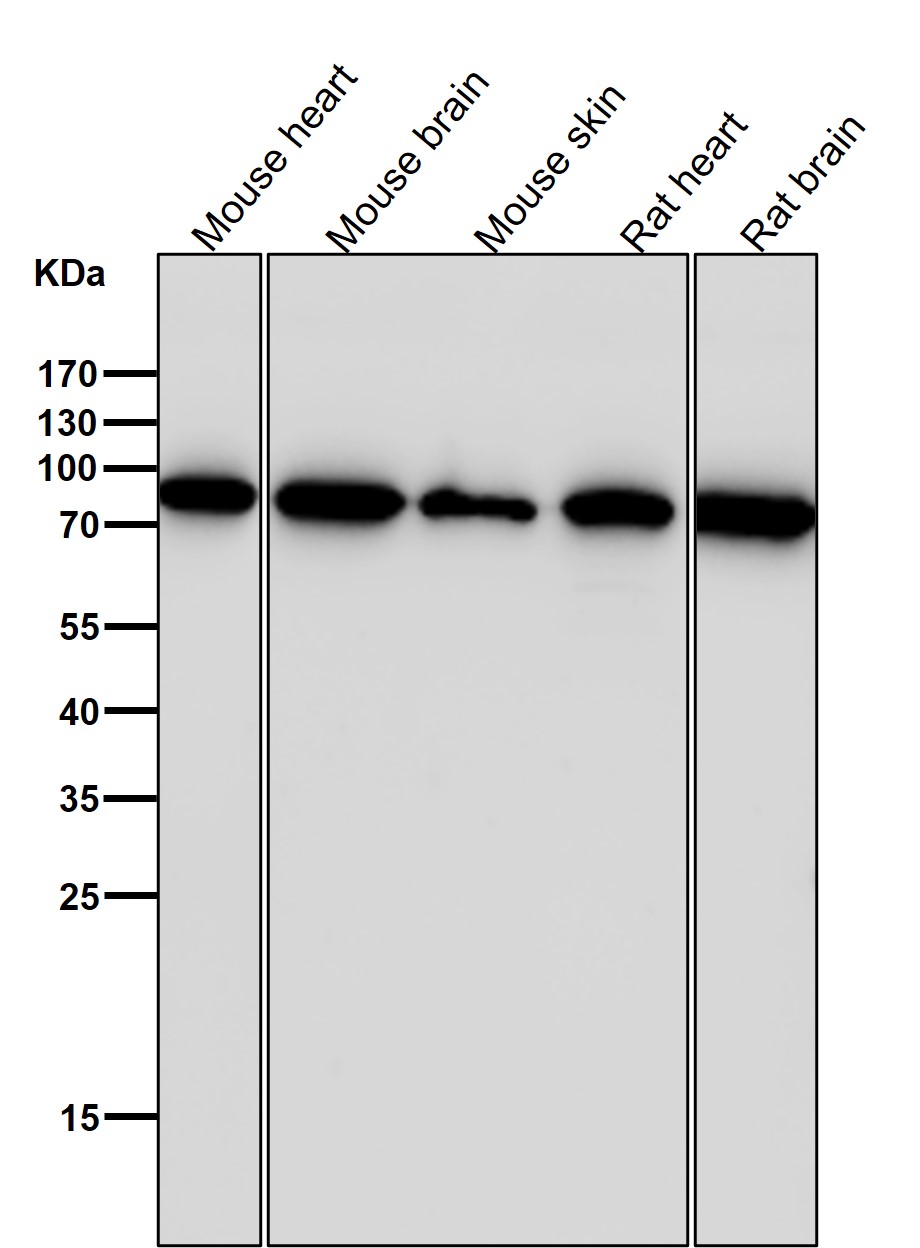 Rabbit Monoclonal to Fructose 6-Phosphate Kinase