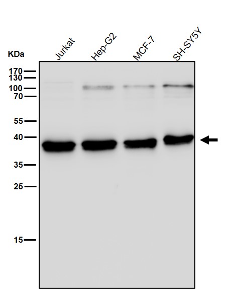 Rabbit Monoclonal to KLRG1