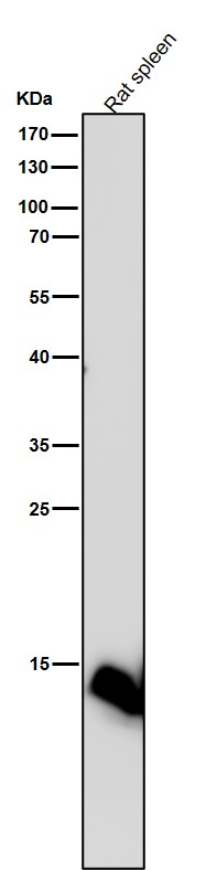 Rabbit Monoclonal to Histone H2B(formylK116)