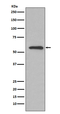 Glucose 6-phosphate isomerase