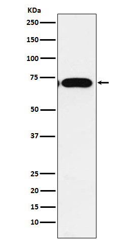 CPEB1