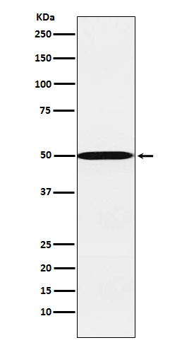CYP26A1