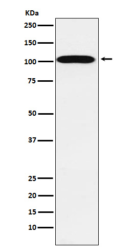 ATP1A2