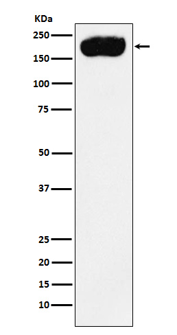 PMCA1