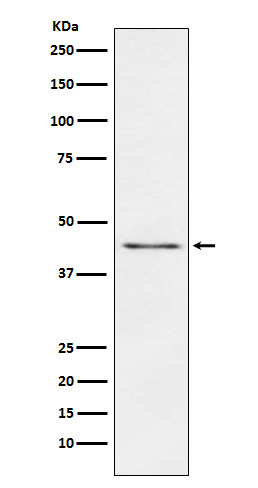 Carboxypeptidase A1/A2/B