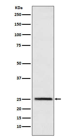 Triose phosphate isomerase