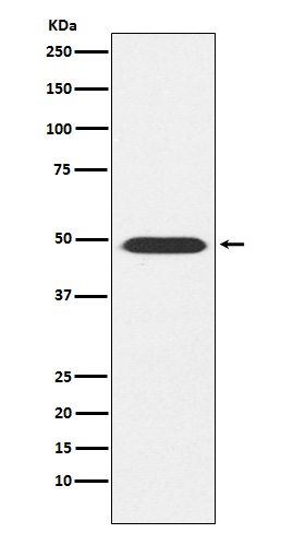 ATP1B1