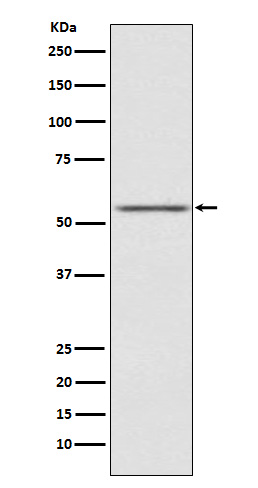 AMHR2