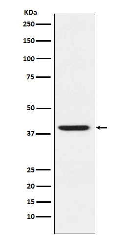 RING2/RING1B/RNF2