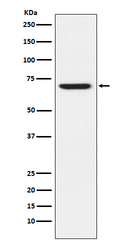 GABA A Receptor alpha 5