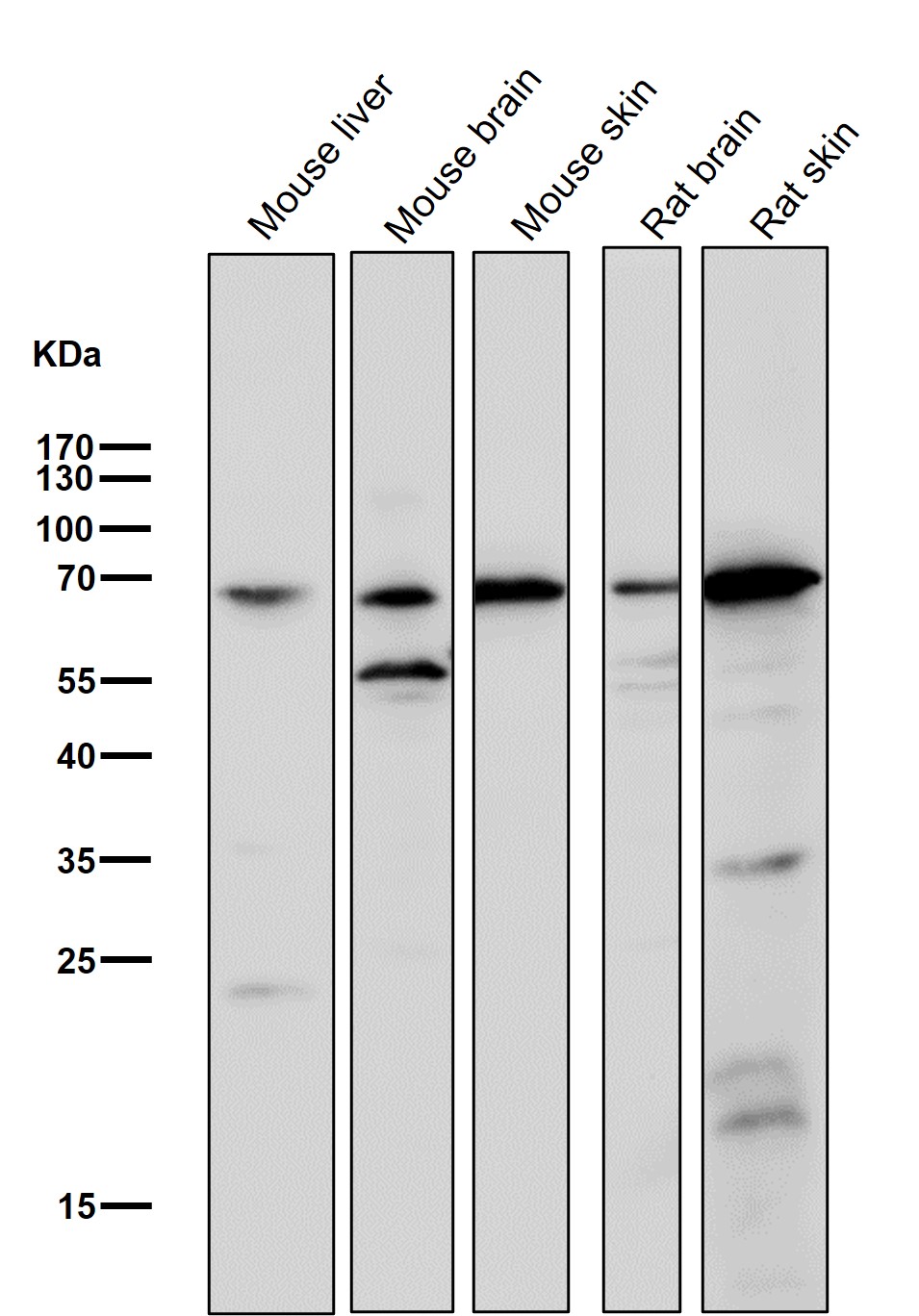 Choline Acetyltransferase