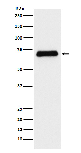 Serotonin transporter