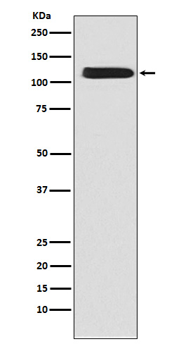NCX1
