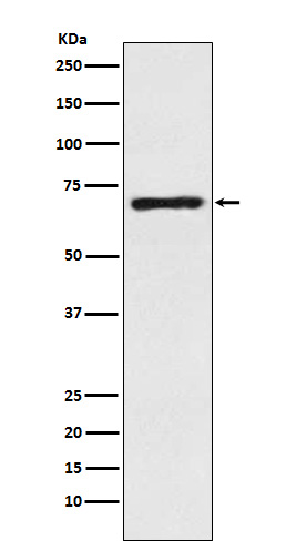 SLC6A1/GAT1
