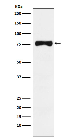 TRP1