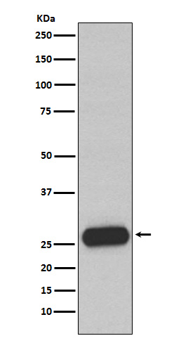 Mast Cell Chymase
