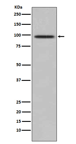 TRAF6BP