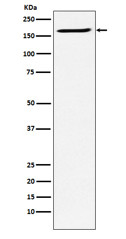 SMC4