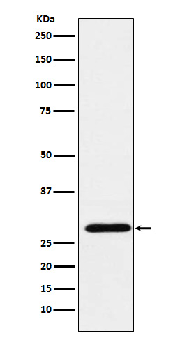 RGS18