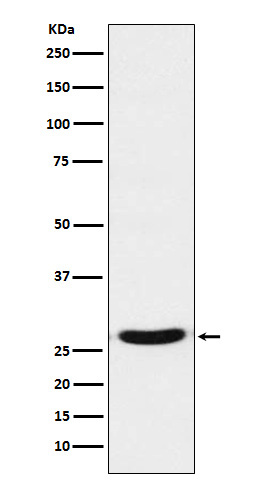 TCF21