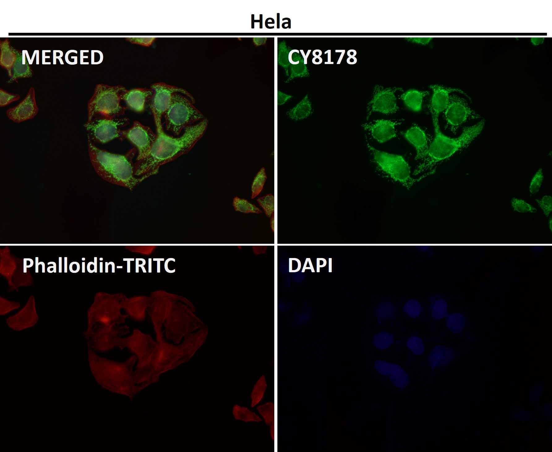 Rabbit Monoclonal to TOMM22