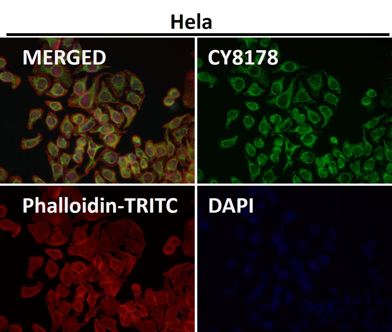 Rabbit Monoclonal to TOMM22
