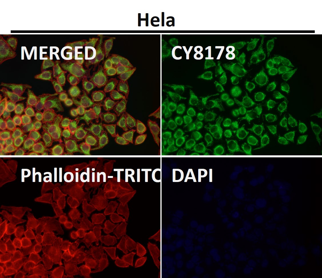 Rabbit Monoclonal to TOMM22
