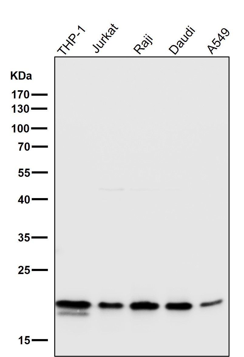 Rabbit Monoclonal to TOMM22