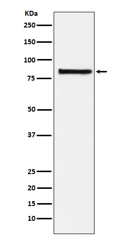 eIF2B epsilon