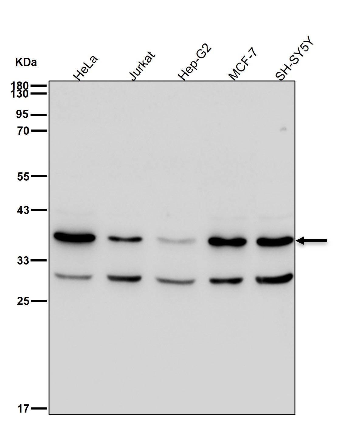 Rabbit Monoclonal to TRBP