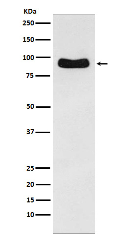 Cenexin1/ODF2